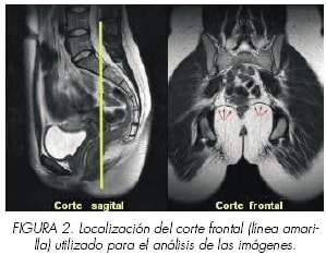 Suelo pélvico