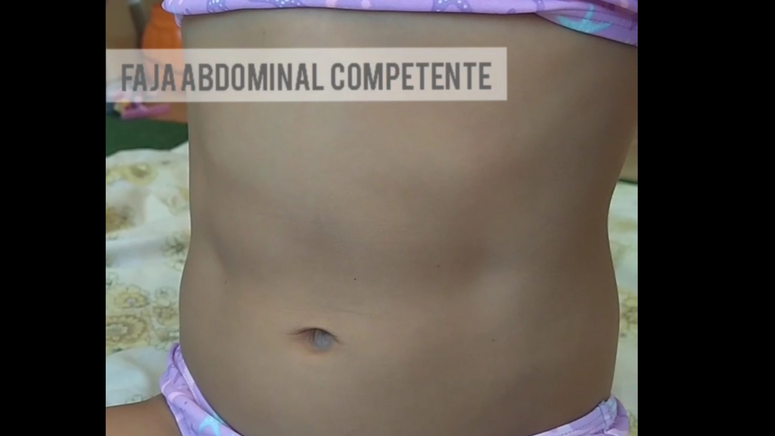 Abdomen funcional